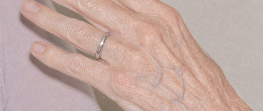 Why Your Hands Age Faster Than Your Face